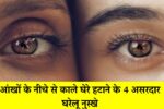 Dark-Circles-Removal-Home-Remedies